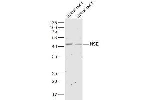 Lane 1: Mouse Spinal cord lysates Lane 2: Rat Spinal cord lysates probed with NSE Polyclonal Antibody, Unconjugated  at 1:300 dilution and 4˚C overnight incubation. (ENO2/NSE antibody  (AA 201-300))