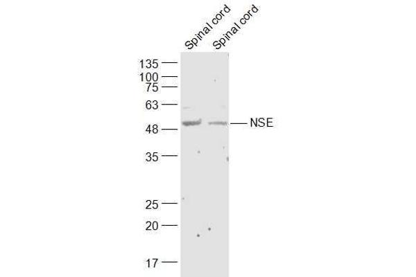 ENO2/NSE anticorps  (AA 201-300)