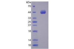 Image no. 1 for Natriuretic Peptide A (NPPA) (AA 25-152) protein (His tag,GST tag) (ABIN4988366)