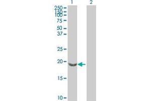 Western Blot analysis of SNCB expression in transfected 293T cell line by SNCB MaxPab polyclonal antibody.