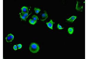 Immunofluorescent analysis of MCF-7 cells using ABIN7143931 at dilution of 1:100 and Alexa Fluor 488-congugated AffiniPure Goat Anti-Rabbit IgG(H+L) (SGCA antibody  (AA 24-290))