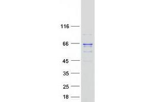 Western Blotting (WB) image for Acyl-CoA Dehydrogenase, Very Long Chain (ACADVL) (Transcript Variant 2) protein (Myc-DYKDDDDK Tag) (ABIN2714302)