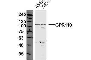 Human A549 and A431 cell lysates probed with GPR110 Polyclonal Antibody, unconjugated  at 1:300 overnight at 4°C followed by a conjugated secondary antibody at 1:10000 for 90 minutes at 37°C.