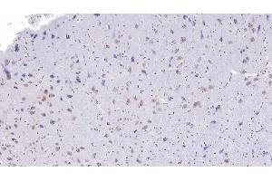 Detection of CC16 in Human Cerebrum Tissue using Monoclonal Antibody to Clara Cell Protein 16 (CC16) (SCGB1A1 antibody  (AA 23-91))