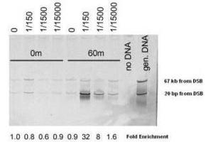 Chromatin Immunoprecipitation (ChIP) using  Affinity Purified Mre11 (S. (Mre11 antibody  (AA 578-590))