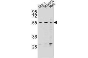 ZNF117 Antibody (N-term) western blot analysis in MCF-7,NCI-H292,A549 cell line lysates (35 µg/lane). (Zinc Finger Protein 117 antibody  (N-Term))