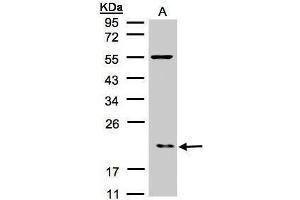 WB Image Sample(30 μg of whole cell lysate) A:Raji , 12% SDS PAGE antibody diluted at 1:500 (ARPC3 antibody)
