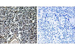 Peptide - +Immunohistochemistry analysis of paraffin-embedded human thymus gland tissue using ABCB7 antibody. (ABCB7 antibody)