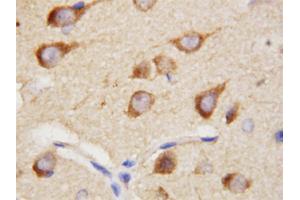Immunohistochemical staining of paraffin embedded rat brain tissue section with PPID polyclonal antibody .