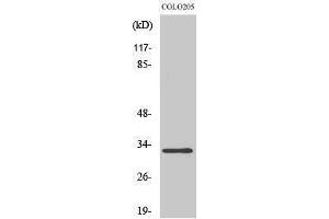 Western Blotting (WB) image for anti-Protein Phosphatase 1, Regulatory (Inhibitor) Subunit 1B (PPP1R1B) (Tyr791) antibody (ABIN3184253) (DARPP32 antibody  (Tyr791))