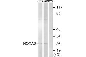 Western blot analysis of extracts from HT-29 cells and K562 cells, using HOXA6 antibody. (HOXA6 antibody  (Internal Region))