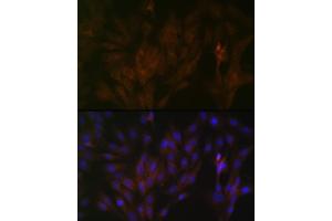 Immunofluorescence analysis of C6 cells using 15-PGDH/HPGD Rabbit mAb (ABIN7267807) at dilution of 1:100 (40x lens). (HPGD antibody)