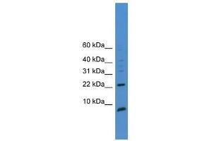 Western Blot showing PSCA antibody used at a concentration of 1-2 ug/ml to detect its target protein. (PSCA antibody  (C-Term))