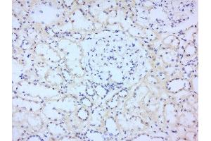 Immunohistochemistry (Paraffin-embedded Sections) (IHC (p)) image for anti-Signal Transducer and Activator of Transcription 2, 113kDa (STAT2) (AA 151-250) antibody (ABIN738246)
