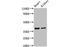 Western Blot Positive WB detected in: Mouse heart tissue, Mouse kidney tissue All lanes: NEUROD1 antibody at 4 μg/mL Secondary Goat polyclonal to rabbit IgG at 1/50000 dilution Predicted band size: 40 kDa Observed band size: 40 kDa (NEUROD1 antibody  (AA 154-356))