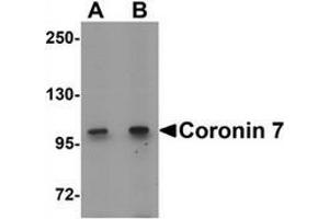 Western blot analysis of Coronin 7 in rat lung tissue lysate with Coronin 7 antibody at (A) 1 and (B) 2 ug/mL. (Coronin 7 antibody  (C-Term))
