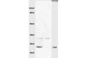 Lane 1: sheep non-fat milk Lane 2: bovine non-fat milk probed with Anti Beta-casein Polyclonal Antibody, Unconjugated (ABIN668976) at 1:200 in 4 °C.