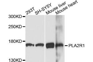 Western blot analysis of extracts of various cells, using PLA2R1 antibody.