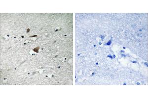 Peptide - +Immunohistochemistry analysis of paraffin-embedded human brain tissue using APC1 antibody. (APC1 antibody  (Internal Region))