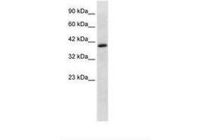 Image no. 1 for anti-Transcription Factor EB (TFEB) (AA 170-219) antibody (ABIN6736030) (TFEB antibody  (AA 170-219))