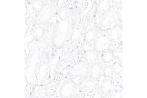 Immunohistochemistry of paraffin-embedded Human kidney (negative control sample) using CD19 antibody (ABIN7266169) at dilution of 1:10000 (40x lens). (CD19 antibody)