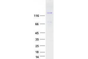 Validation with Western Blot (MAGI3 Protein (Transcript Variant 2) (Myc-DYKDDDDK Tag))