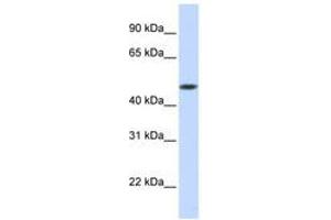 Image no. 1 for anti-Glycosyltransferase 8 Domain Containing 1 (GLT8D1) (AA 288-337) antibody (ABIN6740890) (GLT8D1 antibody  (AA 288-337))