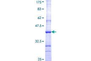 Image no. 1 for Cereblon (CRBN) (AA 343-442) protein (GST tag) (ABIN1350281) (CRBN Protein (AA 343-442) (GST tag))