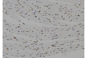ABIN6272522 at 1/100 staining Mouse heart tissue by IHC-P. (NHLH2 antibody  (Internal Region))