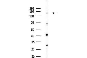 anti-Eukaryotic Translation Initiation Factor 5B (EIF5B) (C-Term) antibody