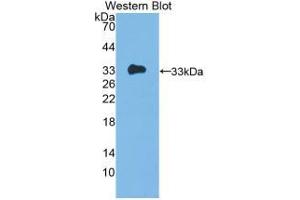 Western blot analysis of recombinant Human IL12A. (IL12A antibody  (AA 23-219))