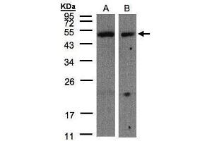 WB Image Sample(30 μg of whole cell lysate) A:A431, B:Hep G2, 10% SDS PAGE antibody diluted at 1:500