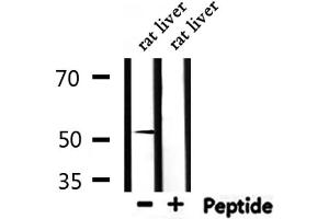 Western blot analysis of extracts from rat liver, using NR0B1 Antibody. (NR0B1 antibody  (Internal Region))