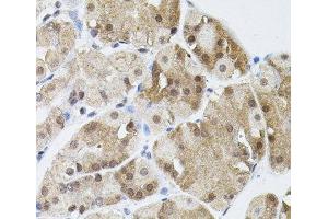 Immunohistochemistry of paraffin-embedded Human stomach using MARVELD2 Polyclonal Antibody (Tricellulin antibody)