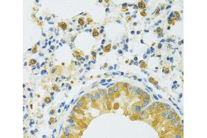 Immunohistochemistry of paraffin-embedded Mouse lung using SLC37A4 Polyclonal Antibody at dilution of 1:100 (40x lens). (SLC37A4 antibody)