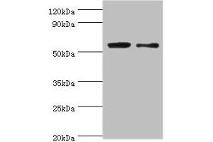 Western blot All lanes: PGD antibody at 2 μg/mL Lane 1: EC109 whole cell lysate Lane 2: 293T whole cell lysate Secondary Goat polyclonal to rabbit IgG at 1/15000 dilution Predicted band size: 54, 52 kDa Observed band size: 54 kDa (PGD antibody  (AA 4-483))