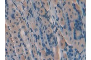 IHC-P analysis of Mouse Stomach Tissue, with DAB staining. (GREM1 antibody  (AA 25-184))