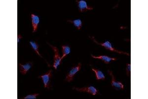 Immunofluorescence analysis of SCF antibody and HeLa cells. (KIT Ligand antibody  (AA 244-273))