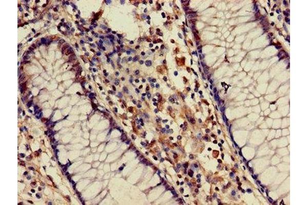 ATIC antibody  (AA 301-592)