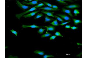 Immunofluorescence of purified MaxPab antibody to CAPN1 on HeLa cell. (CAPNL1 antibody  (AA 1-714))