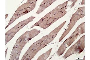 Immunohistochemistry (Paraffin-embedded Sections) (IHC (p)) image for anti-Tumor Necrosis Factor Receptor Superfamily, Member 11a, NFKB Activator (TNFRSF11A) (AA 101-200) antibody (ABIN1714635)