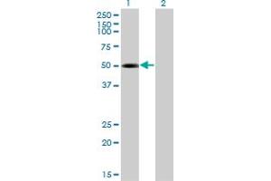 Western Blot analysis of TRIP6 expression in transfected 293T cell line by TRIP6 monoclonal antibody (M04), clone 4B7.