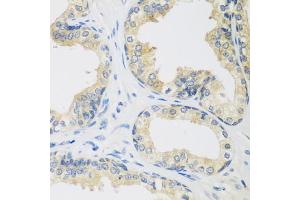 Immunohistochemistry of paraffin-embedded human prostate using UPF2 antibody. (RENT2/UPF2 antibody)