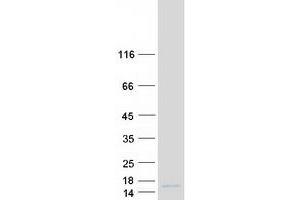 Chromosome 6 Open Reading Frame 226 (C6ORF226) protein (Myc-DYKDDDDK Tag)
