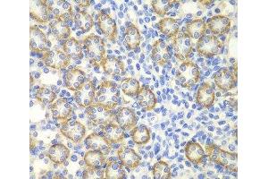 Immunohistochemistry of paraffin-embedded Rat kidney using SYT1 Polyclonal Antibody at dilution of 1:200 (40x lens). (SYT1 antibody)