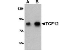 Western blot analysis of TCF12 in HeLa cell lysate with TCF12 antibody at (A) 0. (TCF12 antibody  (N-Term))