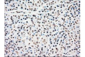 Immunohistochemical staining of paraffin-embedded colon tissue using anti-CHEK2mouse monoclonal antibody.