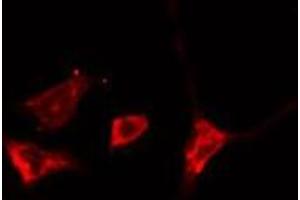 anti-Phospholipase D2 (PLD2) (Internal Region) antibody