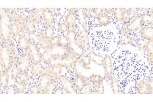 Detection of PLTP in Rat Kidney Tissue using Polyclonal Antibody to Phospholipid Transfer Protein (PLTP) (PLTP antibody  (AA 337-479))