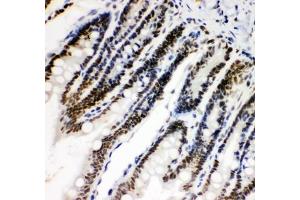 Immunohistochemistry (IHC) image for anti-Hypoxia Inducible Factor 1, alpha Subunit (Basic Helix-Loop-Helix Transcription Factor) (HIF1A) (AA 703-732) antibody (ABIN3028724)
